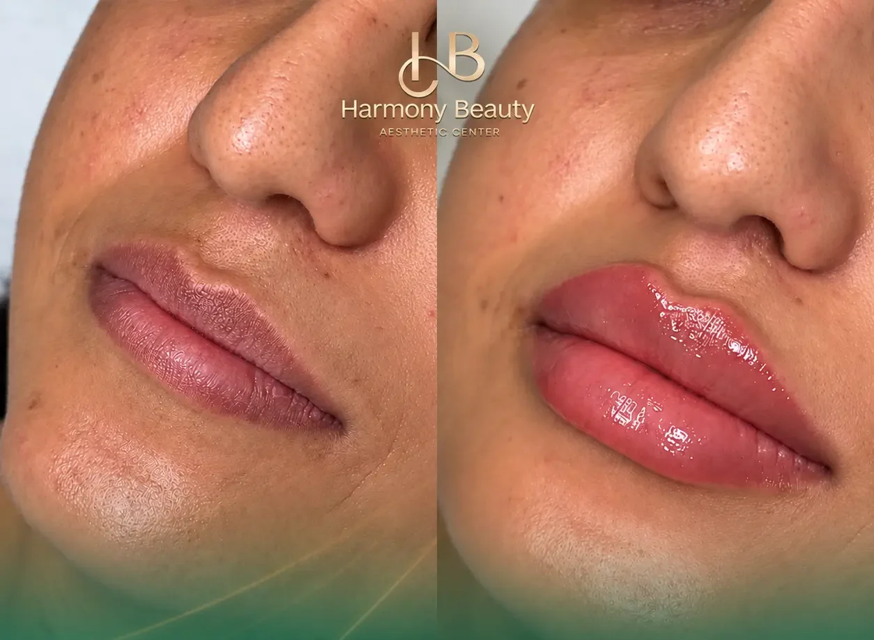 harmony-B2
